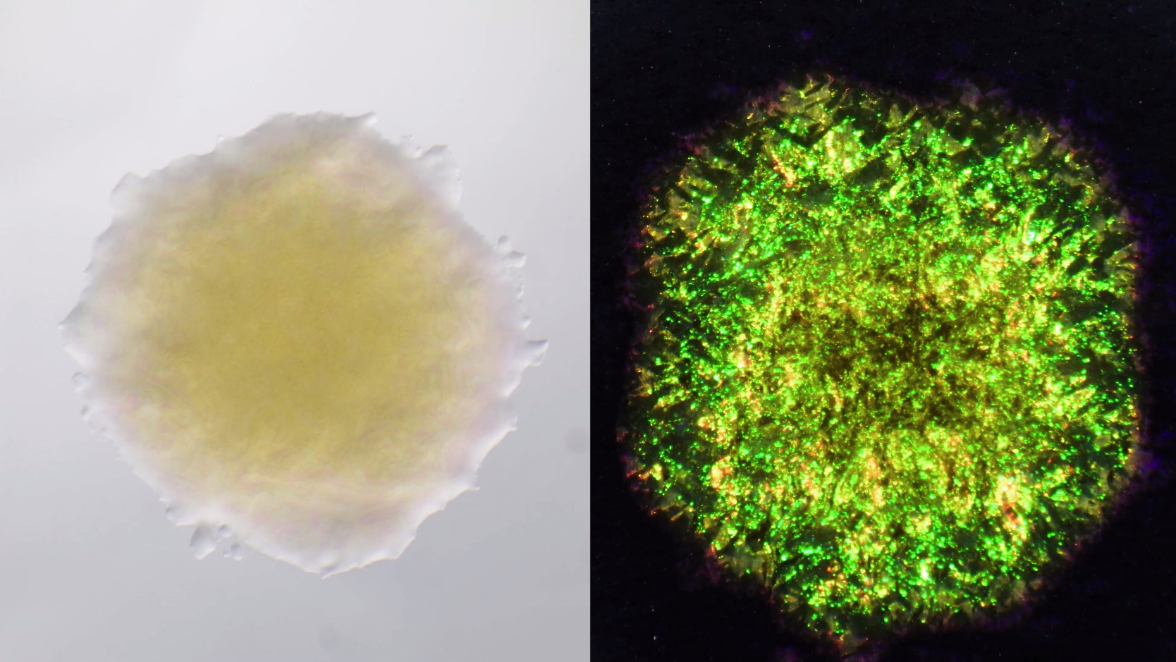 shape of bacterial colony