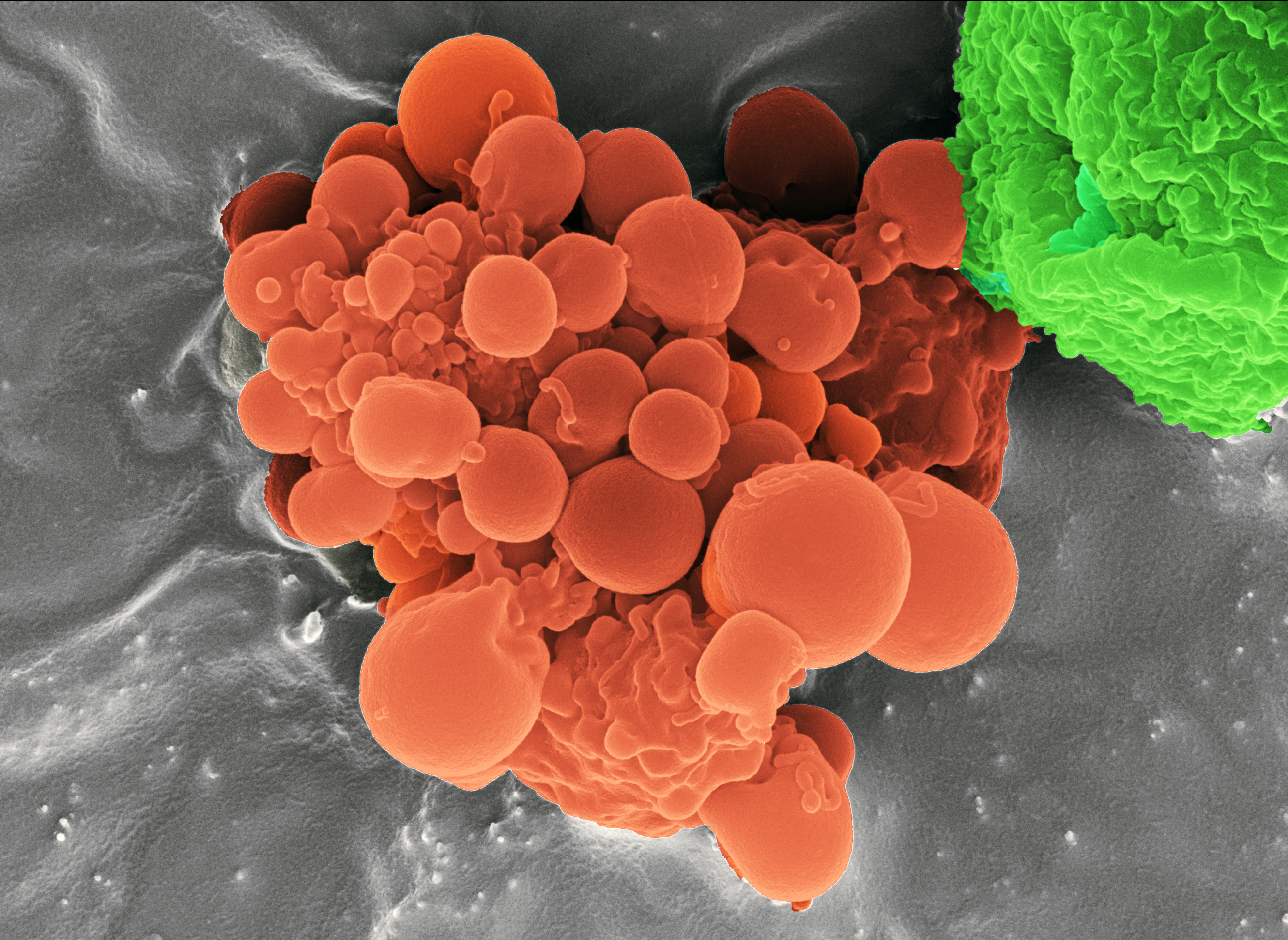Apoptotic cell