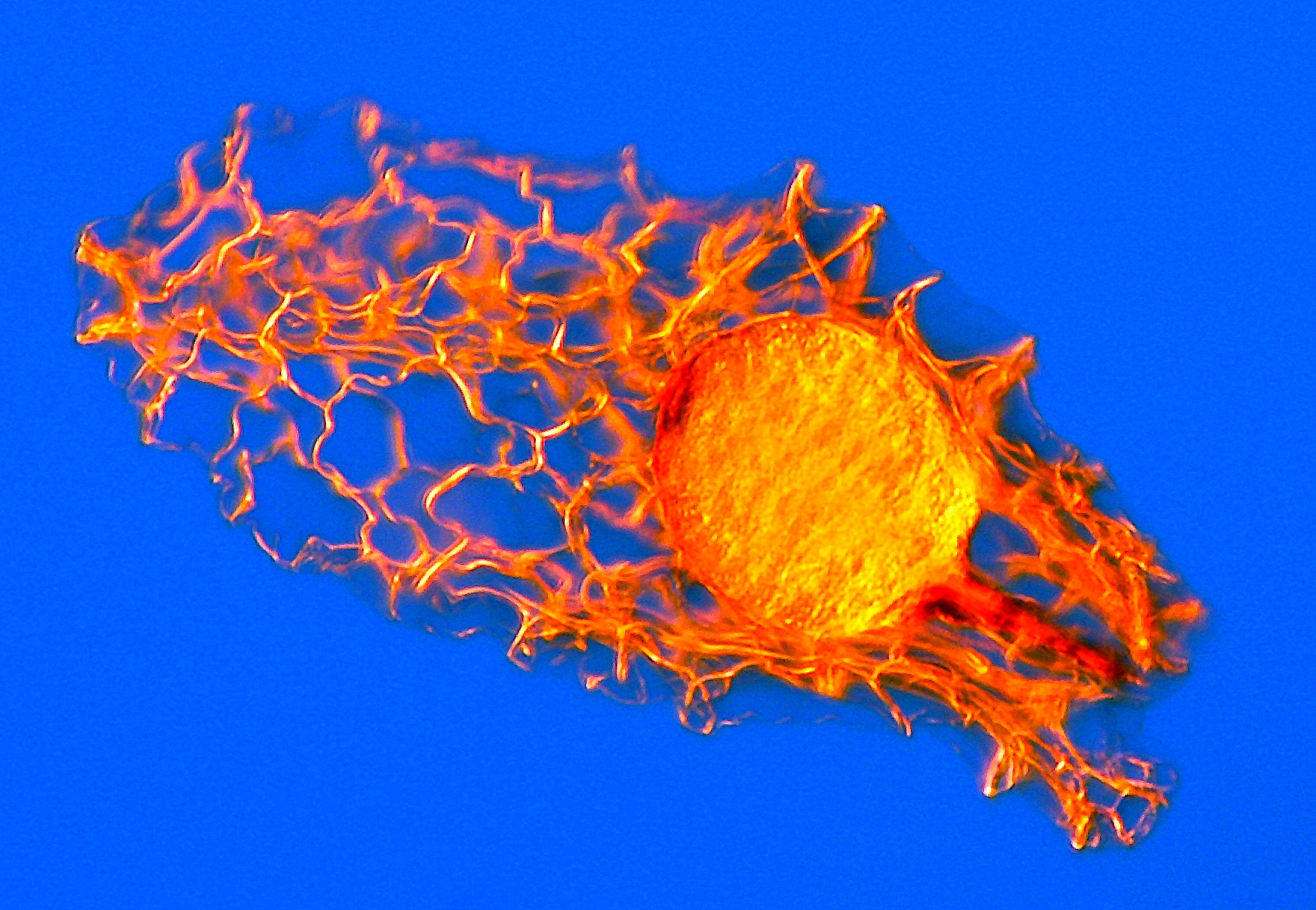 Orchid seed