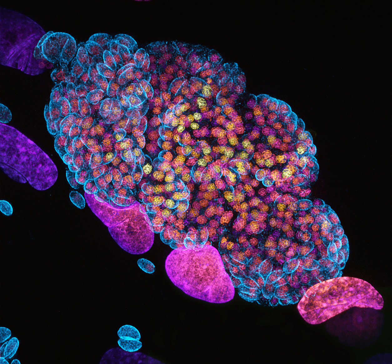 Parasite infection