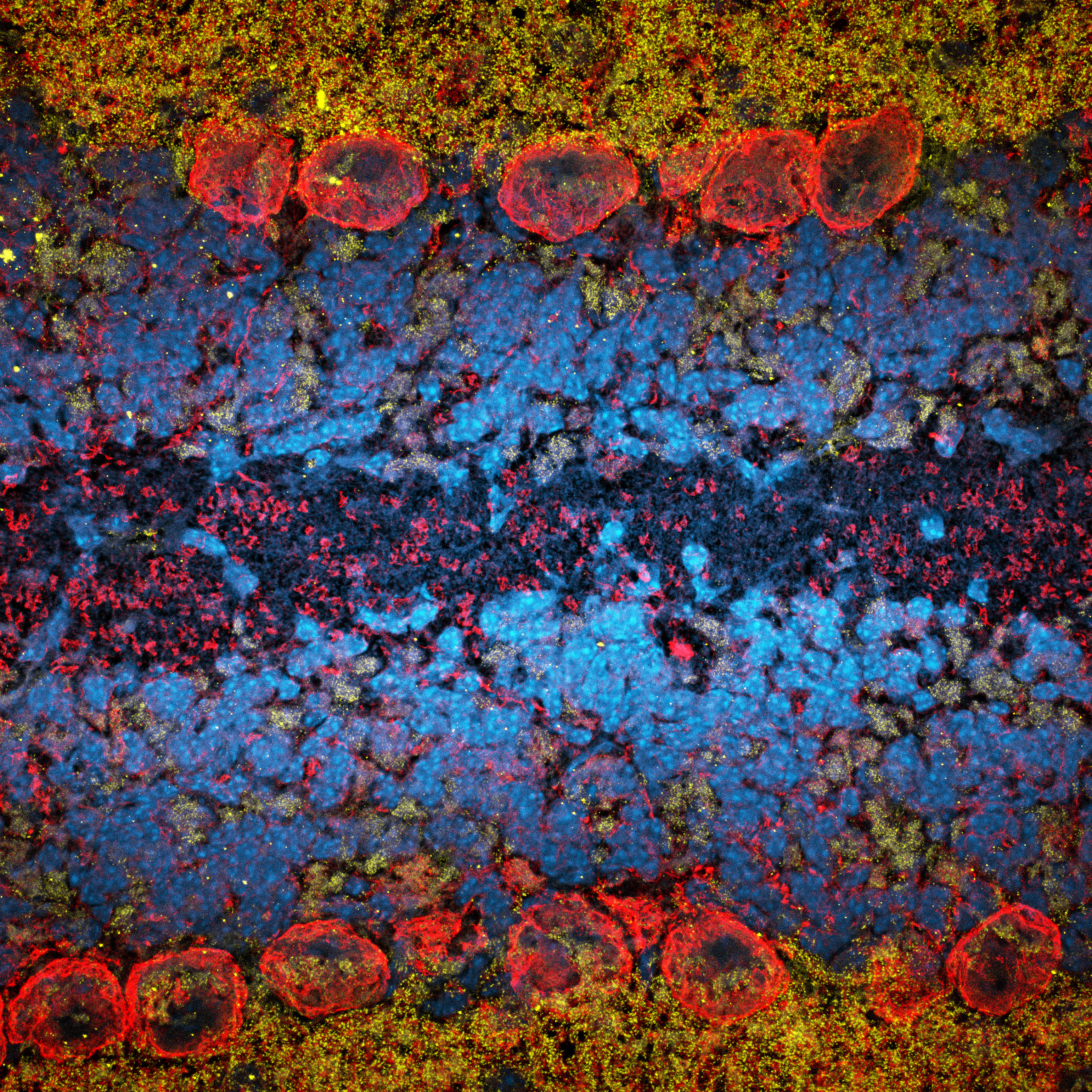 Mouse brain