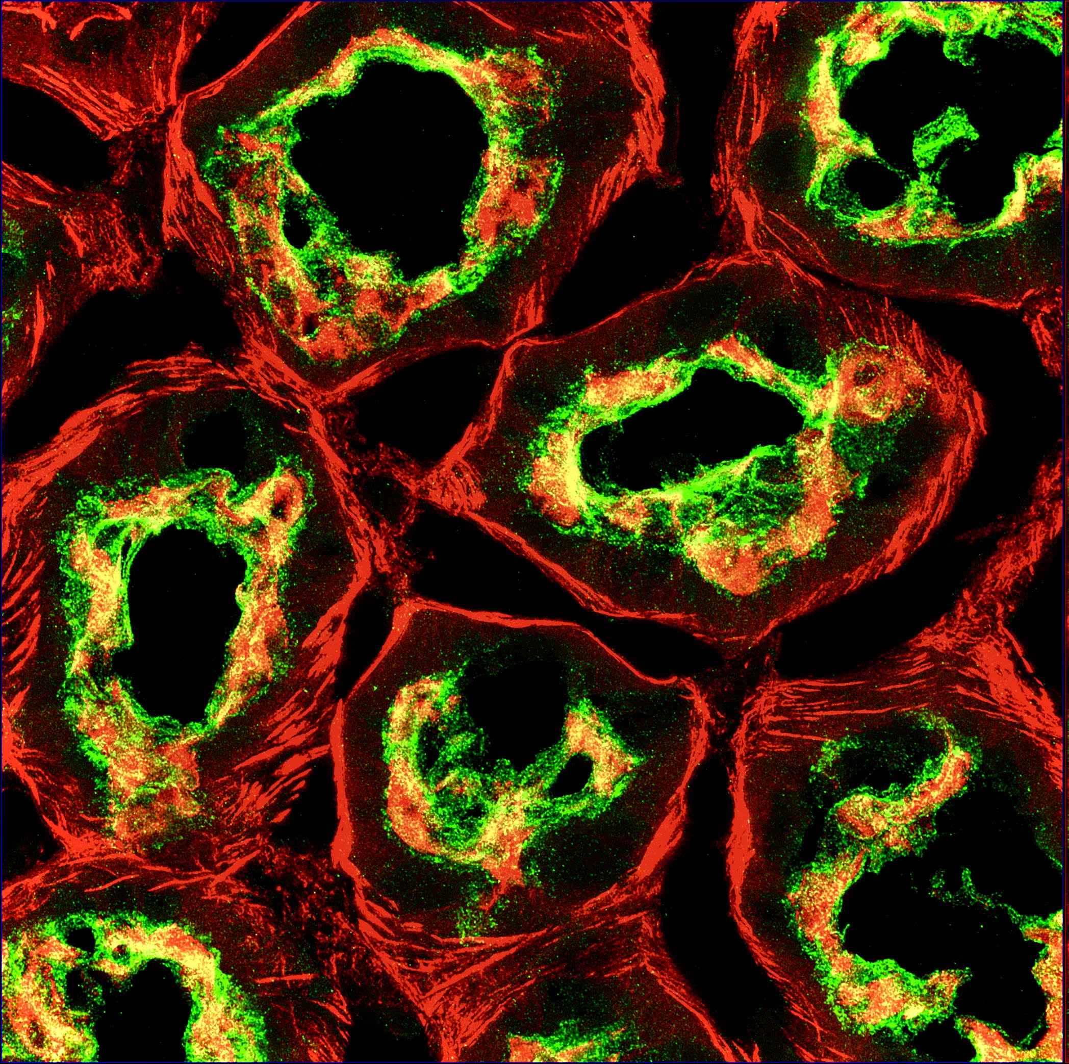Molecular Sentinel