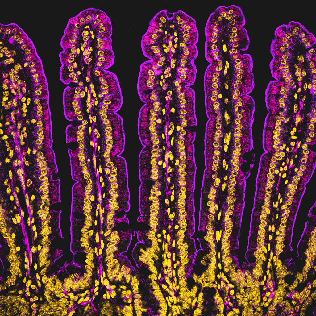 Mouse intestine