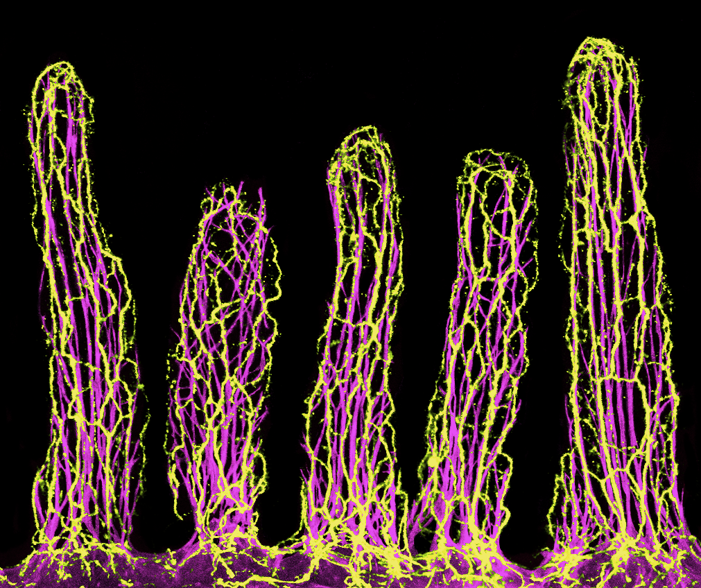 Intestinal neurons