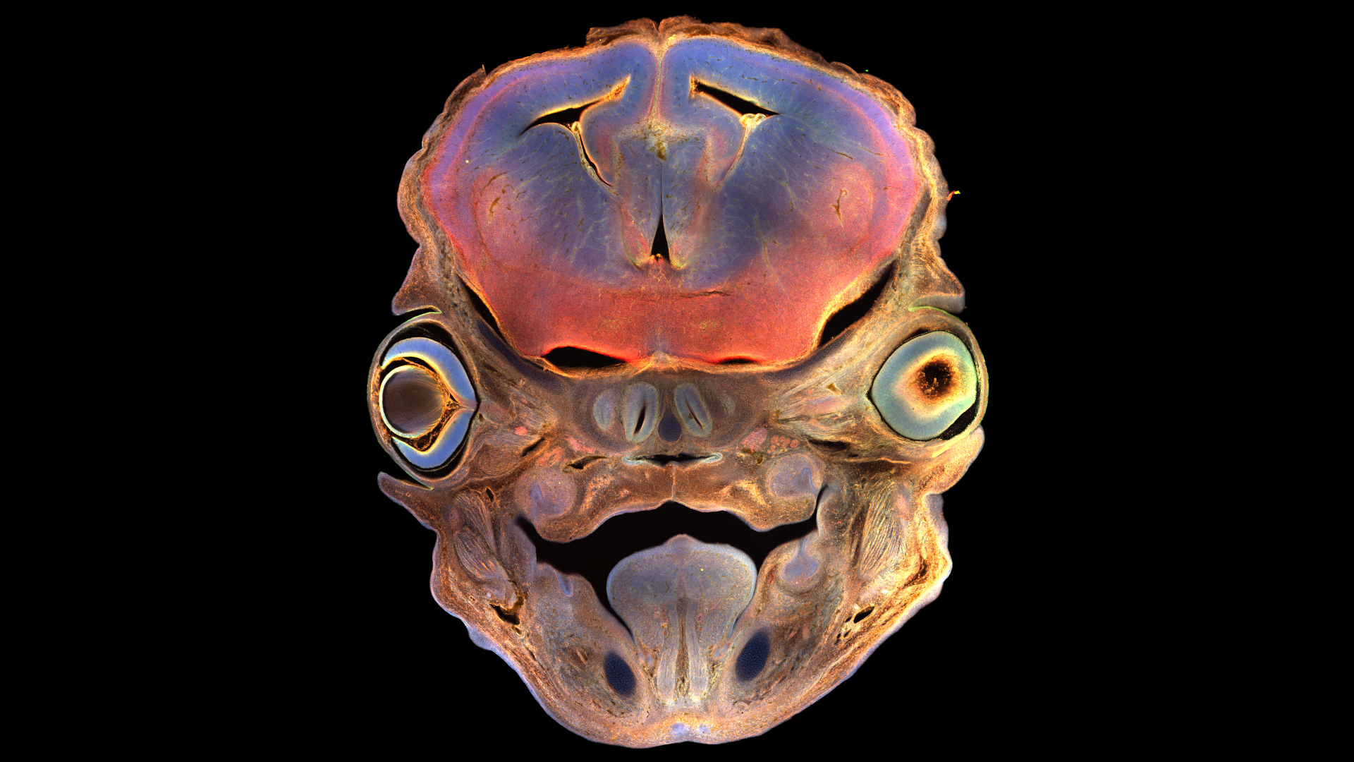 Mouse Embryo Head