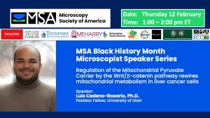 Black History Month Speaker Series - Regulation of the Mitochondrial Pyruvate Carrier by the WntB-catenin pathway rewires mitoc